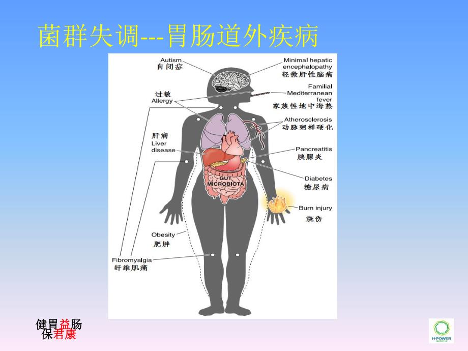 ppt-医院-5.24-消化科 课件.ppt_第3页